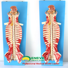 MUSCLE17 (12311) Medical Education Use Spinal Canal Anatomy Modelo 12311